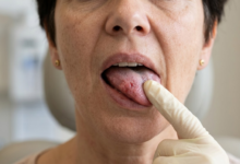 moters veidas iš arti, jos liežuvis šiek tiek iškištas, rodomas jautrus jo šonas