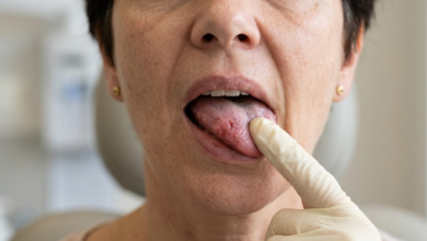 moters veidas iš arti, jos liežuvis šiek tiek iškištas, rodomas jautrus jo šonas