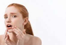 Sausėjančios lūpos